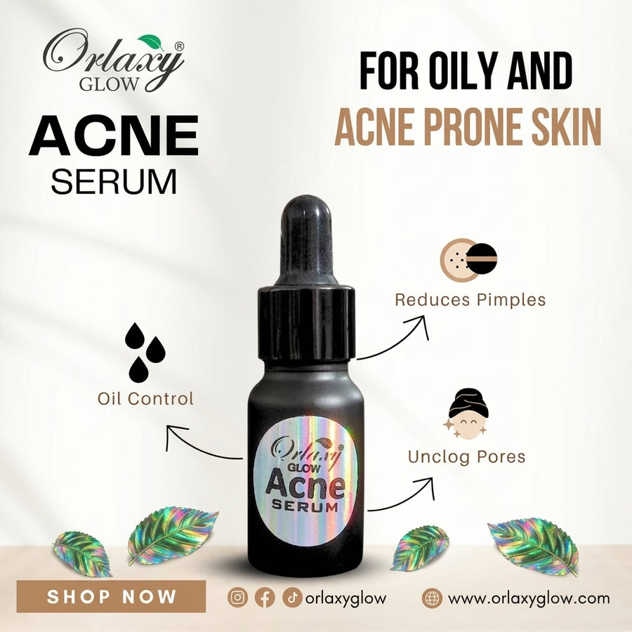 Oily Acne Serum — Made for Oily Skin in Pakistan 🌿