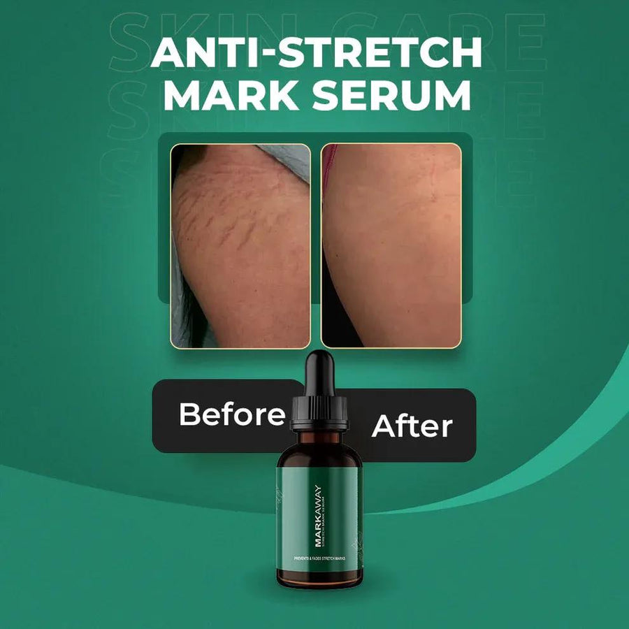 Anti-Aging Stretch Mark Serum